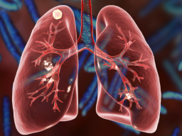 ***NEU*** - Drachenlungen-Verkörperungs-Array (Trauma, Angst aus der Lunge löschen) - Fernausbildung!