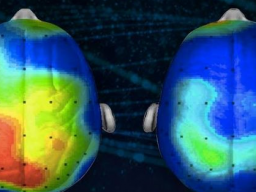 Webinar: Una meditazione contro l'Alzheimer